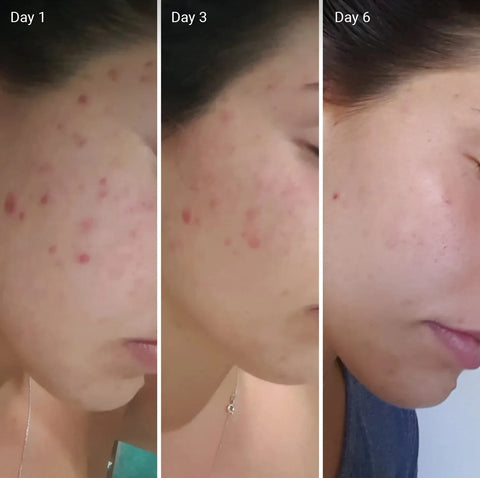 Zafrani Medicated Whitening Cream For Natural Glow